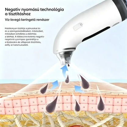 🔥【50% kedvezmény korlátozott ideig】Elektromos arctisztító · Feszesítés és lifting · Mély pórustisztítás